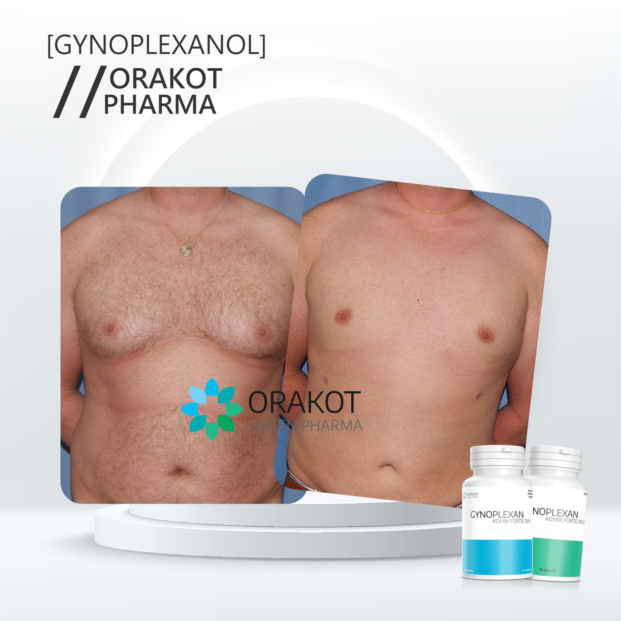 Gynoplexanol Forte DUO gegen Gynäkomastie - Orakot Pharma