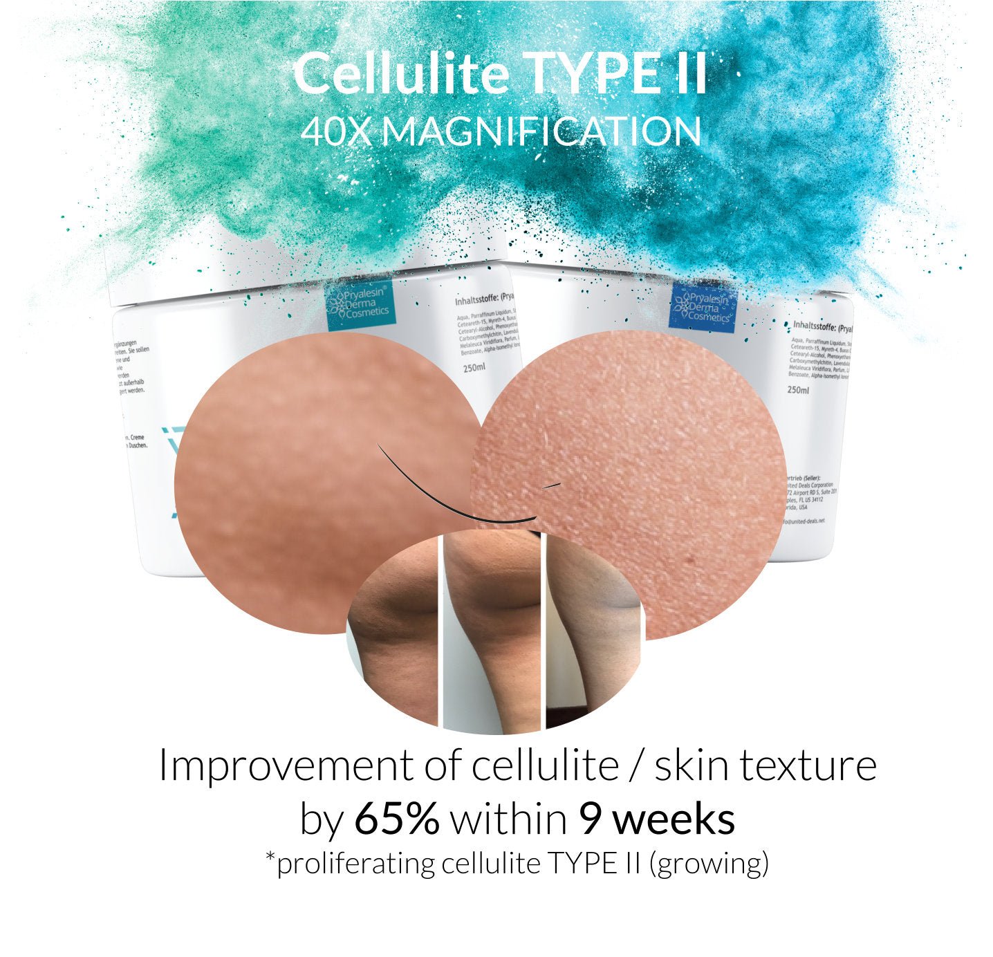 MyNaturalSecret - Pryalesin PROCELL 2 Day+Night Typ 1 - 3 Cellulite